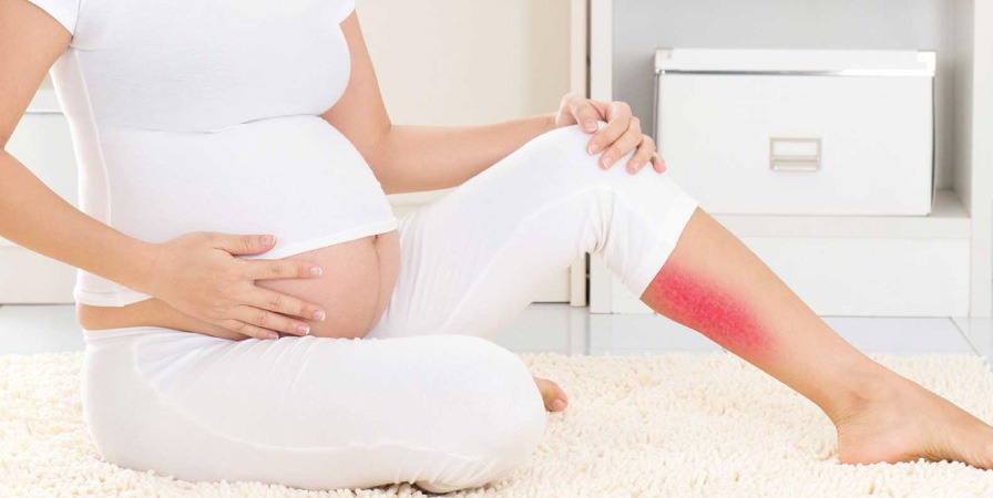 孕婦腳抽筋怎麼辦？教你3招物理方法快速自救、舒緩懷孕抽筋