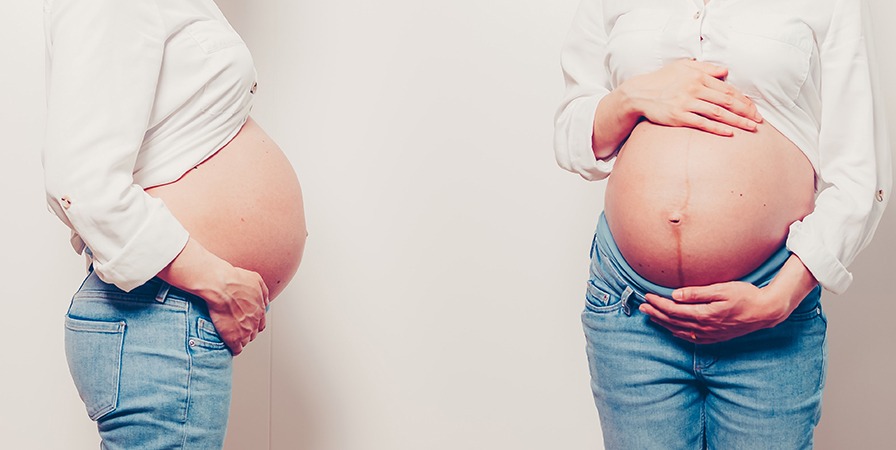 孕期肚皮按摩操，每天3分鐘預防妊娠紋！