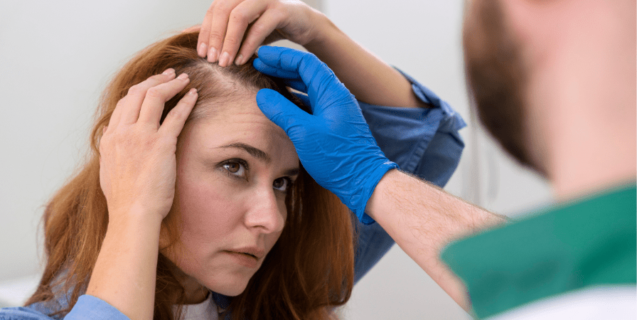 女性雄性禿自我診斷法？掉髮原因、改善方法一次告訴你！